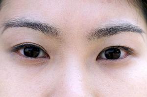 宇都宮市で骨盤矯正を受けるなら